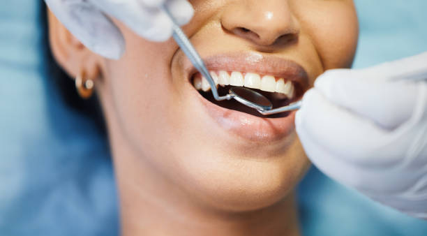 Best Pediatric Emergency Dentist in Fort Myers Shores, FL